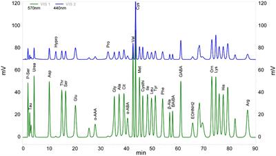 Targeting the metabolic profile of amino acids to identify the key metabolic characteristics in cerebral palsy